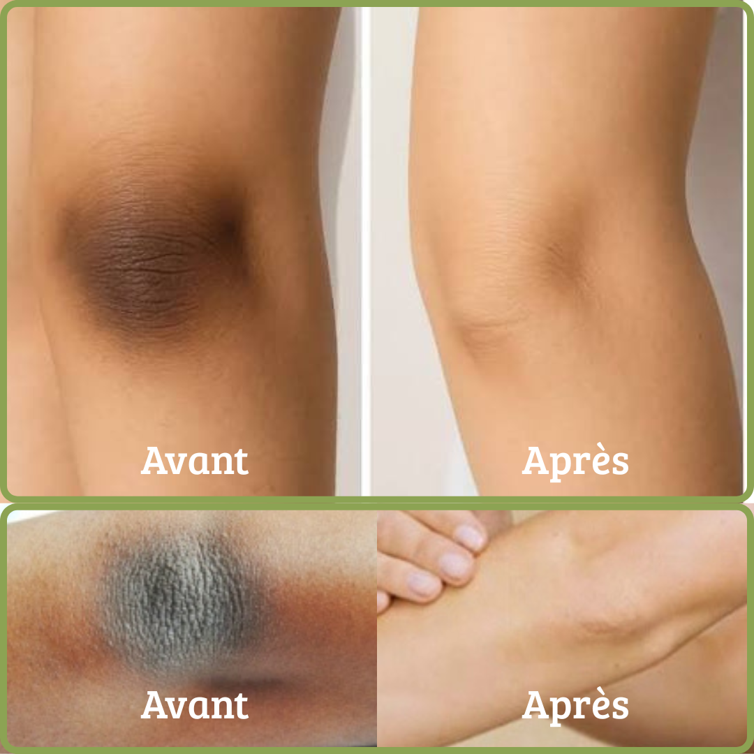 MOOYAM – Crème Anti-tâches, Anti-quintos – Image 2
