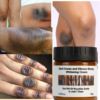 MOOYAM – Crème Anti-tâches, Anti-quintos