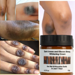 MOOYAM – Crème Anti-tâches, Anti-quintos
