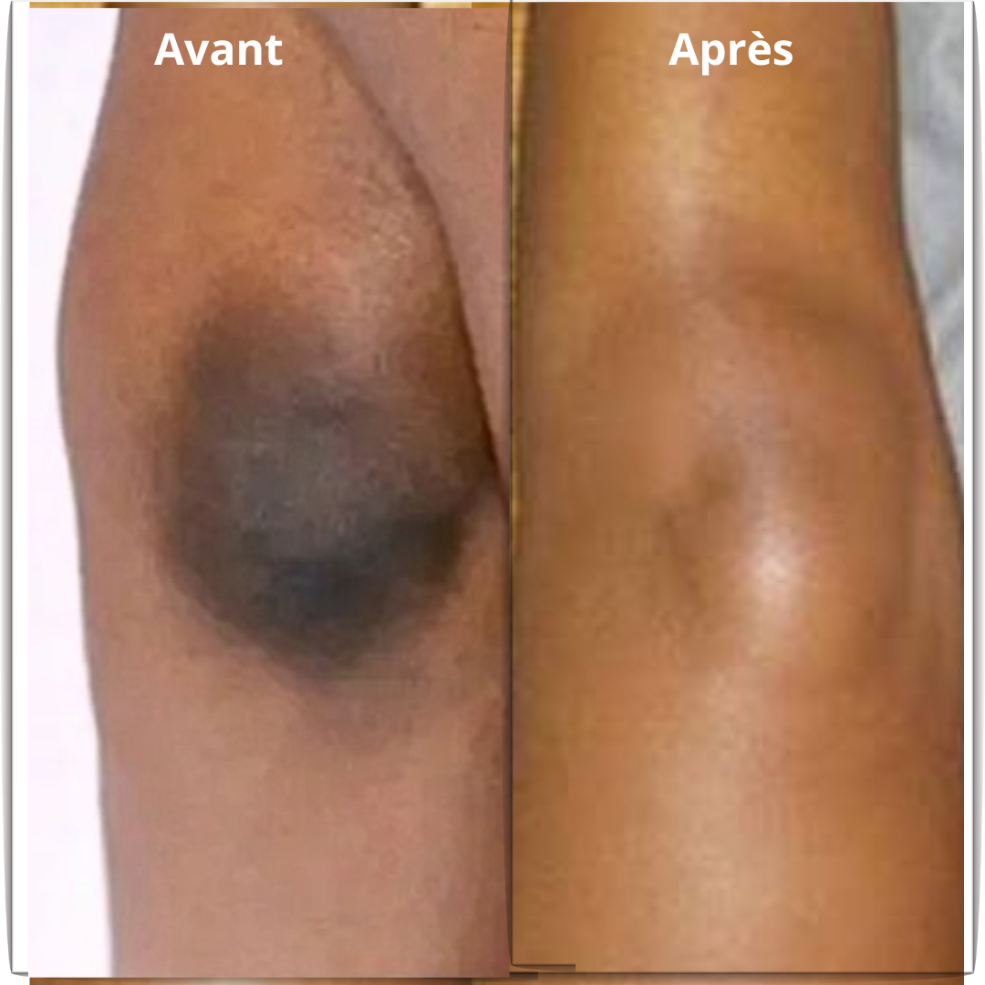 MOOYAM – Crème Anti-tâches, Anti-quintos – Image 3