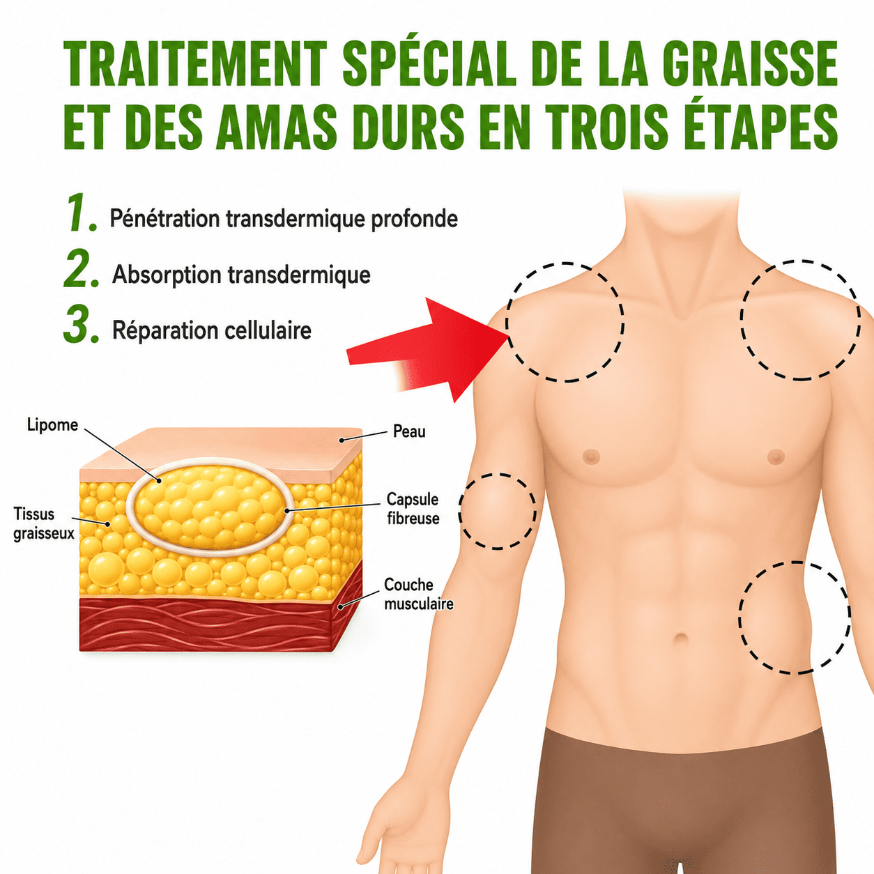 Retrouvez la confiance grâce à LA CRÈME ANTI-LIPOMA – Image 3
