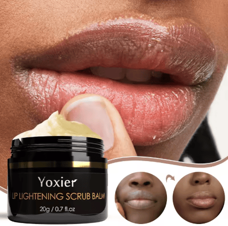 Yoxier – Image 8