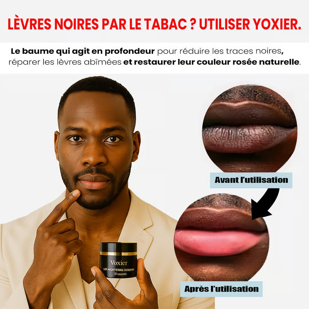 Résultat Yoxier — lèvres lumineuses